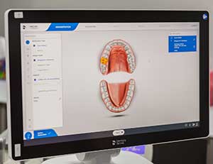 Compuer screen showing digital x-ray